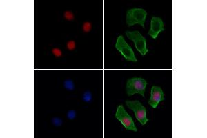 ABIN6263144 and ABIN6277139 staining Hela cells by IF/ICC. (MAX Antikörper  (N-Term))