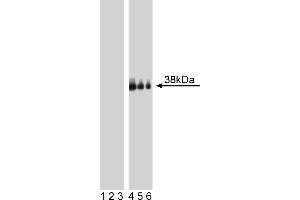 Western Blotting (WB) image for anti-Linker For Activation of T Cells (LAT) (pTyr226) antibody (ABIN967594)