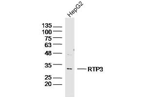 Human HepG2 lysates probed with RTP3 Polyclonal Antibody, Unconjugated  at 1:300 dilution and 4˚C overnight incubation.