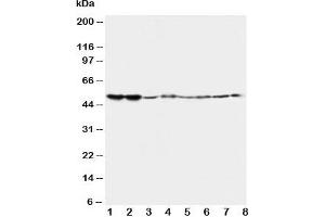 Western blot testing of 5HT2A Receptor antibody and Lane 1:  rat brain;  2: rat brain;  3: mouse brain;  4: mouse brain and human samples  5: U87;  6: SMMC-7721;  7: HT1080;  8: COLO320 (HTR2A Antikörper  (C-Term))