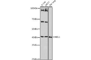 Western blot analysis of extracts of various cell lines, using NEIL1 antibody (ABIN6130579, ABIN6144514, ABIN6144515 and ABIN6221523) at 1:1000 dilution. (NEIL1 Antikörper  (AA 187-476))