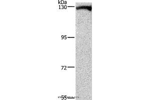 Western blot analysis of Human testis tissue, using DAAM1 Polyclonal Antibody at dilution of 1:400 (DAAM1 Antikörper)