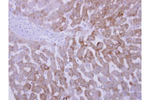IHC-P Image FMO3 antibody [N2C2], Internal detects FMO3 protein at cytosol on human normal liver by immunohistochemical analysis.