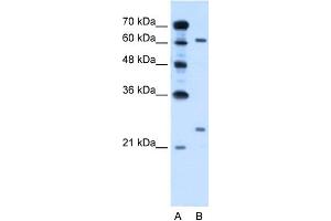 WB Suggested Anti-RORA Antibody Titration:  0. (RORA Antikörper  (Middle Region))