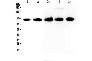 Western blot analysis of CD44 using anti-CD44 antibody . (CD44 Antikörper  (AA 21-259))