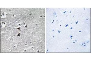 Immunohistochemistry analysis of paraffin-embedded human brain tissue, using Tryptophan Hydroxylase (Ab-260) Antibody. (Tryptophan Hydroxylase 1 Antikörper  (AA 231-280))