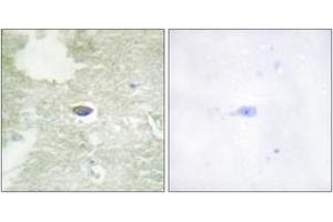 Immunohistochemistry analysis of paraffin-embedded human brain, using TGF beta Receptor II (Phospho-Ser225/250) Antibody. (TGFBR2 Antikörper  (pSer225))