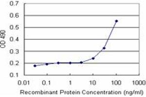 TNFRSF1B (Human) Matched Antibody Pair