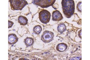 Paraformaldehyde-fixed, paraffin embedded mouse skin, Antigen retrieval by boiling in sodium citrate buffer (pH6) for 15min, Block endogenous peroxidase by 3% hydrogen peroxide for 30 minutes, Blocking buffer at 37°C for 20min, Antibody incubation with Cytochrome C (1F10) Monoclonal Antibody  at 1:50 overnight at 4°C, followed by a conjugated secondary and DAB staining. (Cytochrome C Antikörper)