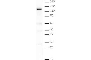 PARP-1 N-terminal antibody tested by Western blot. (PARP1 Antikörper  (N-Term))