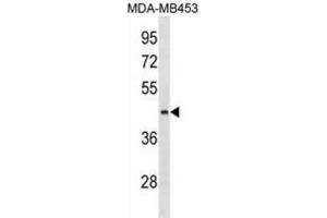 Western Blotting (WB) image for anti-Asparagine-Linked Glycosylation 8, alpha-1,3-Glucosyltransferase Homolog (ALG8) antibody (ABIN3000312) (ALG8 Antikörper)
