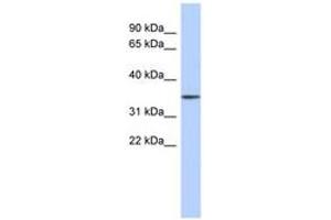 Image no. 1 for anti-F-Box Protein 31 (FBXO31) (AA 431-480) antibody (ABIN6743760) (FBXO31 Antikörper  (AA 431-480))