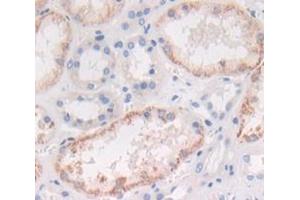 IHC-P analysis of Human Tissue, with DAB staining. (IL1A Antikörper  (AA 113-271))