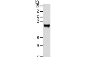 Western Blot analysis of Human fetal liver tissue using TRIM14 Polyclonal Antibody at dilution of 1/800 (TRIM14 Antikörper)