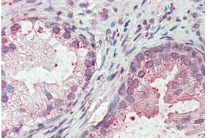 Anti-SLC44A2 antibody  ABIN960812 IHC staining of human prostate. (SLC44A2 Antikörper  (Internal Region))