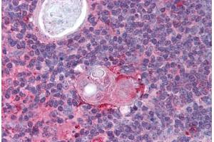 Human Thymus (formalin-fixed, paraffin-embedded) stained with IKBKB antibody ABIN297183 at 2. (IKBKB Antikörper  (AA 310-376))