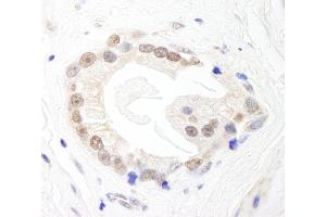 Immunohistochemistry (IHC) image for anti-BRF1, RNA polymerase III transcription initiation factor subunit (BRF1) (AA 550-600) antibody (ABIN7453666)