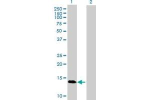 Western Blot analysis of GBA3 expression in transfected 293T cell line by GBA3 MaxPab polyclonal antibody. (GBA3 Antikörper  (AA 1-162))