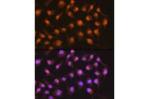 Immunofluorescence analysis of HeLa cells using PER2 Rabbit mAb (ABIN7269224) at dilution of 1:100 (40x lens). (PER2 Antikörper)