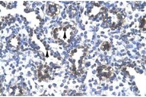 Immunohistochemical staining (Formalin-fixed paraffin-embedded sections) of human lung with FOXA3 polyclonal antibody  at 4-8 ug/mL working concentration. (FOXA3 Antikörper  (Internal Region))