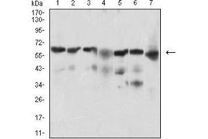 Western blot analysis using BACE1 mouse mAb against Hela (1), SK-N-SH (2), HepG2 (3), C6 (4), PC-12 (5), PANC-1 (6), NIH/3T3 (7) cell lysate. (BACE1 Antikörper  (AA 112-324))