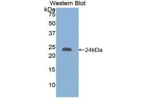 Western Blotting (WB) image for anti-Collagen, Type XVIII (COL18) (AA 1572-1754) antibody (ABIN1858449) (COL18 Antikörper  (AA 1572-1754))