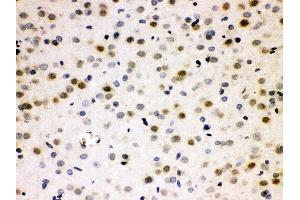 Anti- Cdc25B Picoband antibody, IHC(P) IHC(P): Rat Brain Tissue (CDC25B Antikörper  (AA 119-248))