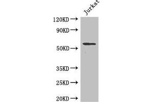 Western Blot Positive WB detected in: Jurkat whole cell lysate All lanes: SPPL2A antibody at 2 μg/mL Secondary Goat polyclonal to rabbit IgG at 1/50000 dilution Predicted band size: 59 kDa Observed band size: 59 kDa (SPPL2A Antikörper  (AA 26-172))