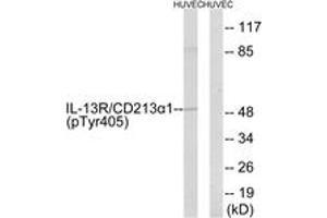 Western blot analysis of extracts from HuvEc cells treated with serum 20% 15', using IL-13R alpha1 (Phospho-Tyr405) Antibody. (IL13 Receptor alpha 1 Antikörper  (pTyr405))