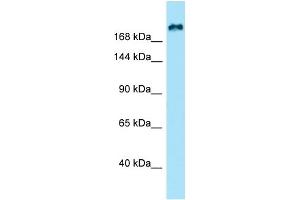 WB Suggested Anti-KIF21B Antibody Titration: 1. (KIF21B Antikörper  (N-Term))