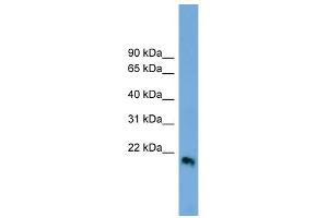 IFN Beta 1 antibody used at 1 ug/ml to detect target protein. (IFN beta 1 (Middle Region) Antikörper)