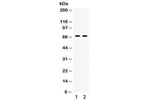 Western blot testing of human 1) A431 and 2) A549 lysate with Involucrin antibody. (Involucrin Antikörper)