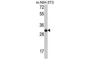 Image no. 1 for anti-Four and A Half LIM Domains 1 (FHL1) (C-Term) antibody (ABIN453000) (FHL1 Antikörper  (C-Term))
