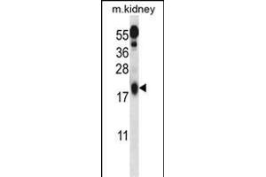 Ufc1 Antibody (C-term) (ABIN650703 and ABIN2839221) western blot analysis in mouse kidney tissue lysates (35 μg/lane).