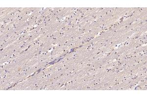 Detection of CHEM in Human Cerebrum Tissue using Monoclonal Antibody to Chemerin (CHEM) (CHEM (AA 33-158) Antikörper)