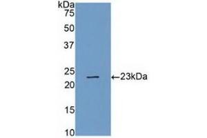 Detection of Recombinant CASP4, Human using Polyclonal Antibody to Caspase 4 (CASP4) (Caspase 4 Antikörper  (AA 78-265))