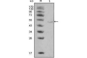 Western Blot showing LPL antibody used against Hela cell lysate (1). (Lipoprotein Lipase Antikörper)