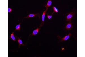 anti-Signal Transducer and Activator of Transcription 5B (STAT5B) (AA 675-703), (C-Term) antibody