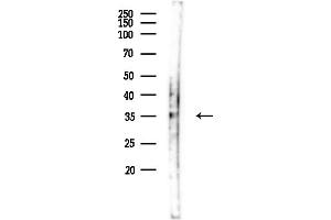 anti-Dehydrogenase/reductase (SDR Family) Member 3 (DHRS3) (Internal Region) antibody