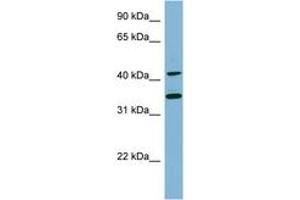 Image no. 1 for anti-B-Cell Linker (BLNK) (C-Term) antibody (ABIN6741821) (B-Cell Linker Antikörper  (C-Term))