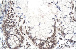 Rabbit Anti-ZNF394 Antibody Catalog Number: ARP30072 Paraffin Embedded Tissue: Human Intestine Cellular Data: Epithelial cells of intestinal villas Antibody Concentration: 4. (ZNF394 Antikörper  (N-Term))