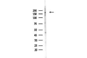 Western blot analysis of lysates from PC12 cells(starvation 24h treatment), using Phospho-eNOS (Ser1177) Antibody at 1/1000 dilution.