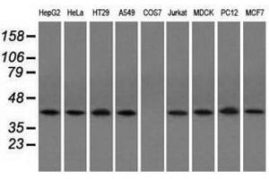 Image no. 2 for anti-Acetyl-CoA Acetyltransferase 2 (ACAT2) antibody (ABIN1496401) (ACAT2 Antikörper)