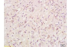 Formalin-fixed and paraffin embedded rat brain tissue labeled with Anti-Phospho-Caspase-9 (Thr125) Polyclonal Antibody, Unconjugated (ABIN683863) at 1:200 followed by conjugation to the secondary antibody and DAB staining