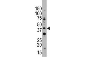 CD33 antibody used in western blot to detect CD33 in Jurkat cell lysate.