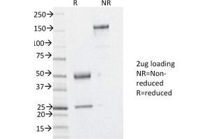 SDS-PAGE Analysis Purified YBX1 Mouse Monoclonal Antibody (YBX1/2430). (YBX1 Antikörper)