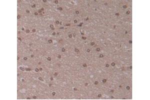 IHC-P analysis of Human Brain Tissue, with DAB staining. (ENPP2 Antikörper  (AA 637-905))