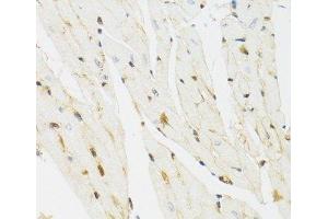 Immunohistochemistry of paraffin-embedded Mouse heart using THAP1 Polyclonal Antibody at dilution of 1:100 (40x lens). (THAP1 Antikörper)