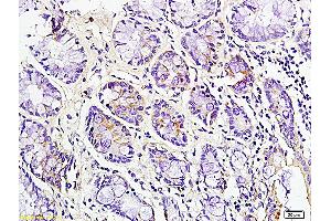 Formalin-fixed and paraffin embedded mouse intestine labeled with Rabbit Anti CD163 Polyclonal Antibody, Unconjugated (ABIN741570) at 1:200 followed by conjugation to the secondary antibody and DAB staining (CD163 Antikörper  (AA 1001-1121))