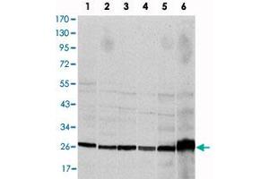 Western blot analysis using CASP8 monoclonal antibody, clone 1H11  against HeLa (1), Jurkat (2), THP-1 (3), NIH/3T3 (4), COS-7 (5) and PC-12 (6) cell lysate. (Caspase 8 Antikörper)